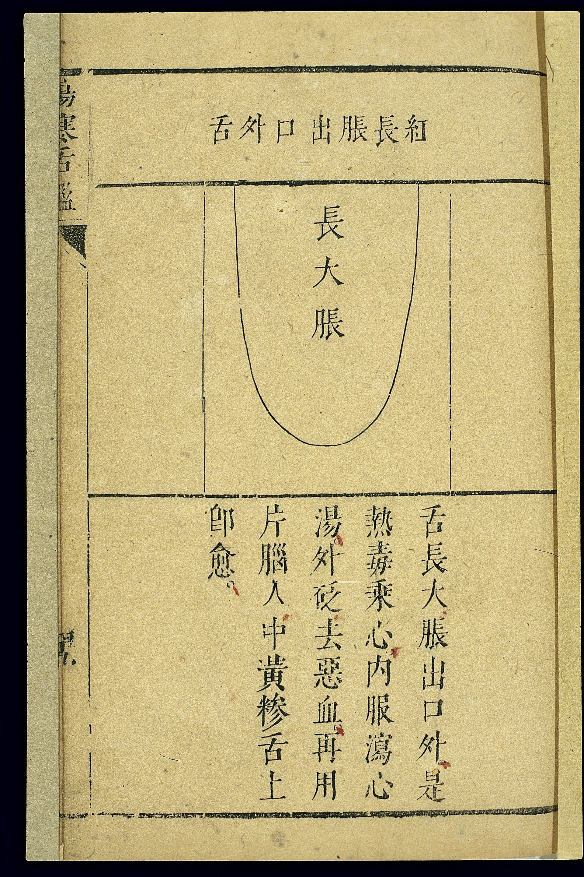 Planche de diagnostic par la langue, Shanghan she jian, 1668